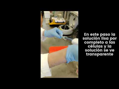 Extracción de ADN plasmídico: fundamento y procedimiento detallado