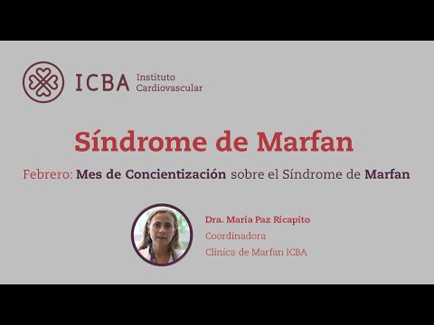 Características del Síndrome de Marfan: Un Estudio Detallado.