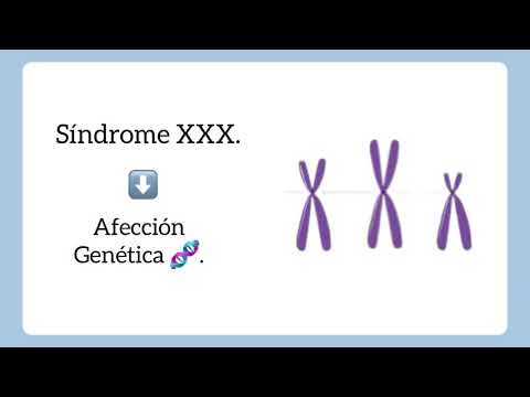Características del síndrome de triple X: Un análisis detallado de sus atributos
